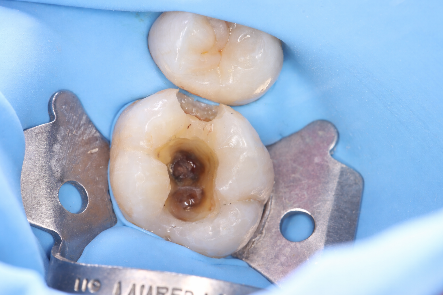 Rehabilitación Oral